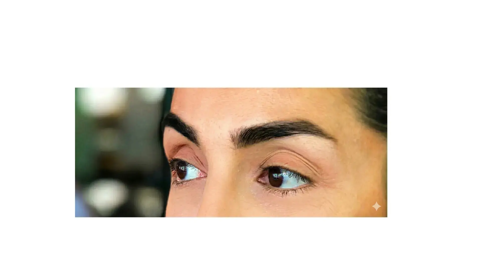 Lidstraffung in Hamburg - Beratung bei Schlupflidern und Blepharoplastik